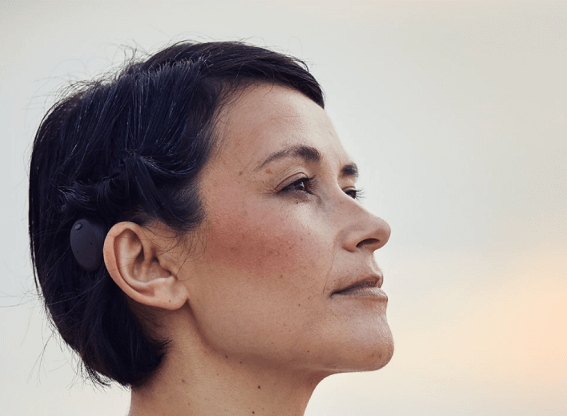 Ventajas de los Implantes Auditivos